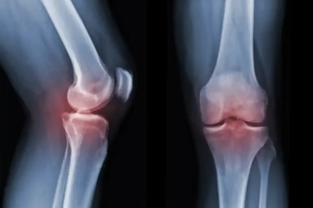 Essential Tips to Prevent Powerlifting Injuries
